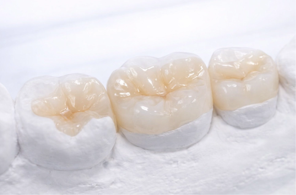 Odontología restauradora y de mínima invasión